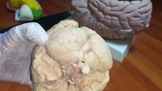 Anatomy of Cerebellum  Lab Demo  Dr Yusuf [upl. by Anairad96]