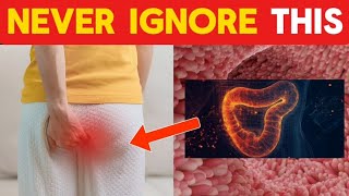 Critical Colon Cancer Symptoms You Should Never Ignore [upl. by Benson]