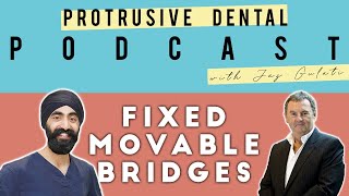 Understanding FixedMovable Bridges with Prof Tipton PDP EP43 [upl. by Arual]