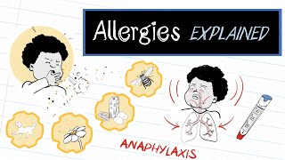 What are Allergies HealthSketch [upl. by Koffler]