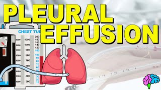 Pleural effusion  transudative vs exudative  causes symptoms pathophysiology  resp msn part5 [upl. by Roselba]