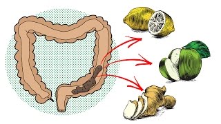 9 Home Remedies for Natural Colon Cleansing [upl. by Aihsemak]