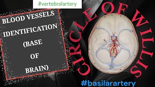 Circle of Willis  Spotting of Vessels  Branches of Vertebral Basilar Internal carotid artery [upl. by Longfellow]