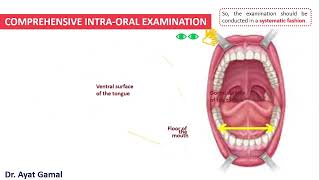 Intraoral exam part 6 tongue ventrum amp floor [upl. by Millda]