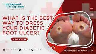 What is the Best Way to Dress Your Diabetic Foot Ulcer [upl. by Vic858]