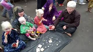 Albino Beggars of India [upl. by Elias]