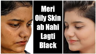 Oily Skin Care Tips  No more Blackness Pimples Dark Spots  आयली स्किन का कैसे रखें ख्याल [upl. by Sheridan]