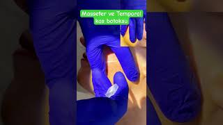 Bruksizm botoks uygulaması dentist antalya dentalclinic zahnarzt dentistry stomatolog [upl. by Daisi395]