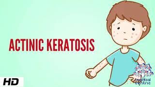 Actinic keratosis Causes Signs and Symptoms Diagnosis and Treatment [upl. by Vick]