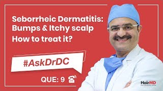 How To Treat Seborrheic Dermatitis कैसे seborrheic का इलाज करे  AskDrDc Ep 9  In HINDI [upl. by Alesiram]