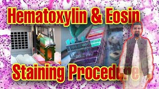 Performing routine Hematoxylin amp Eosin stainingHistopathology Lab [upl. by Llehcam]