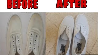 Removing Yellow Stains from White ShoesDIY Stain Cleansing [upl. by Ethbin]