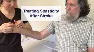 Treating Spasticity after Stroke [upl. by Issac349]