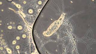 Philodina Rotifer  HD [upl. by Gypsy]