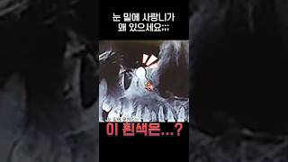 🦷눈 밑에 사랑니가 난 사람 ㅎㄷㄷjpg [upl. by Nelo]