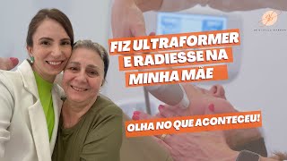 Fiz Ultraformer e Radiesse na minha Mãe olha o que aconteceu  Dra Giselle Barban [upl. by Taub411]