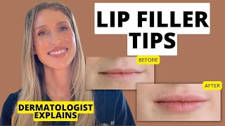 Dermatologist Shares 9 Lip Filler Tips to Know Before and After Treatment [upl. by Ilaire]