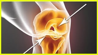 Comment régénérer rapidement des cartilages endommagés [upl. by Anos39]