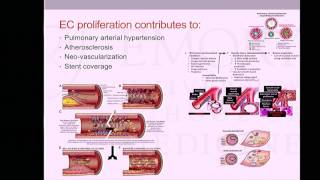 Emory Cardiology Grand Rounds 05152017 [upl. by Swiercz296]