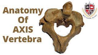 Axis Vertebra Anatomy 2nd Cervical VertebraHuman Osteology [upl. by Eiramassenav437]