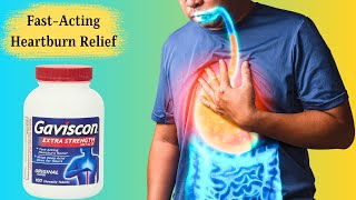 Gaviscon Extra Strength Antacid Tablets  FastActing Heartburn Relief [upl. by Maurreen]