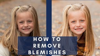 How to Remove Blemishes in Lightroom [upl. by Yffat614]