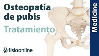 Cómo tratar la Osteopatía de pubis Quirúrgico y conservador [upl. by Godfry]