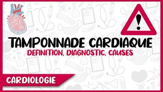 La Tamponnade Cardiaque  Déf Diagnostic Positif et Différentiel Causes [upl. by Edas]