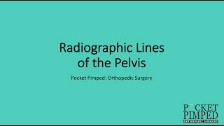 Radiographic Lines of the Pelvis [upl. by Corrie]