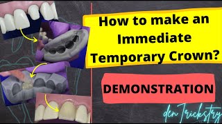 How to make an IMMEDIATE TEMPORARY CROWN Direct Temporization Technique  Demonstration [upl. by Dareen]