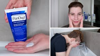 How to use PanOxyl 10 Benzoyl Peroxide Acne Foaming Wash [upl. by Gnouhp]