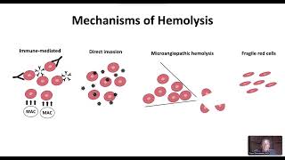 Hemolytic Anemia Overview [upl. by Ahsiuqat]