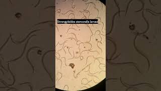 Strongyloides stercoralis larvae Strongyloidiasis parasiteParasite under microscope microscopy [upl. by Ellett]