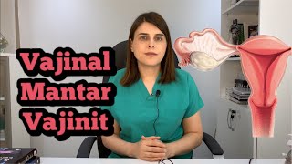 ❓ Vajinal Mantar Belirtileri Nelerdir  Op Dr Funda Yazıcı Erol [upl. by Eico]