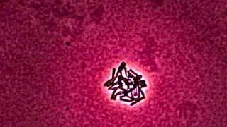 Lactobacillus  Time Lapse Photography [upl. by Hennebery]