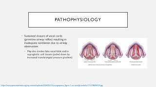 Common Perioperative Complications Keyword Review  Dr Green [upl. by Nemaj]