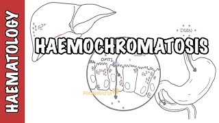 Haemochromatosis Iron Overload  iron physiology causes and pathophysiology [upl. by Brine]