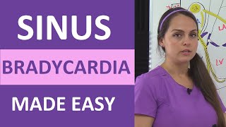 Sinus Bradycardia ECGEKG Interpretation Causes Treatment Nursing NCLEX Review Cardiac [upl. by Irollam271]