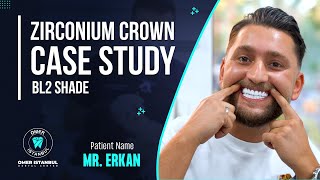 Zirconia Crown Case Study BL2 Shade  Narrated by Dr Omer Karaaslan [upl. by Rolando]