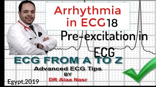 ECG from A to Z intermediate level Arrhythmia 18 Dr Alaa Nasr 2019 [upl. by Vincentia]