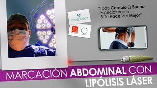 Elimina grasa del abdomen con esta rutina  Ejercicios en casa [upl. by Gui]