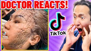 Plastic Surgeon Reacts to OUTRAGEOUS TikTok Videos [upl. by Anama970]