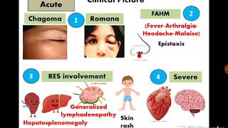 9 American trypanosomiasis  Dr Noha Madbouly [upl. by Zemaj690]