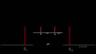 Normal Heart Sounds [upl. by Malda193]