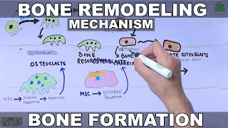 Intracranial Hemorrhage EpiduralSubduralSubarachnoid overview [upl. by Rett]