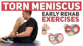 Meniscus Tear  Start With These Rehab Exercises [upl. by Hedges]