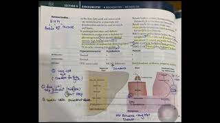 Ketone bodies synthesis made EASY hindi neetpg inicet firstaidusmle biochemistry [upl. by Ewald]