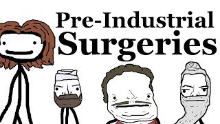 PreIndustrial Surgeries [upl. by Tatman]