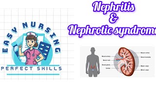 Nephritis amp Nephrotic syndrome 4th sem [upl. by Jedediah]