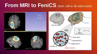 From MRI to FEniCS 3D xdmf mesh [upl. by Chura]